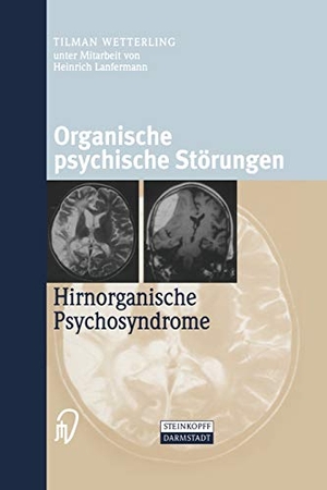 Wetterling, Tilman. Organische psychische Störungen - Hirnorganische Psychosyndrome. Steinkopff, 2012.