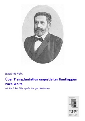 Hahn, Johannes. Über Transplantation ungestielter Hautlappen nach Wolfe - mit Berücksichtigung der übrigen Methoden. EHV-History, 2014.
