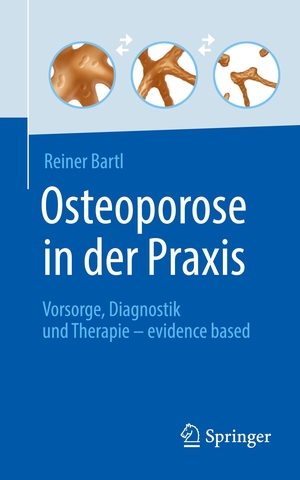 Bartl, Reiner. Osteoporose in der Praxis - Vorsorge, Diagnostik und Therapie ¿ evidence based. Springer Berlin Heidelberg, 2022.