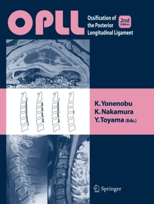 Yonenobu, K. / Y. Toyama et al (Hrsg.). OPLL - Ossification of the Posterior Longitudinal Ligament. Springer Japan, 2006.