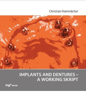 Hammächer, Christian. Implants and dentures - a working skript. mgo fachverlage, 2025.