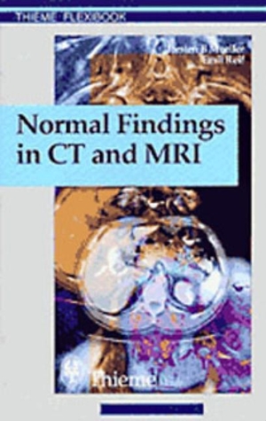 Möller, Torsten Bert / Emil Reif. Normal Findings in CT and MRI, A1, print. Georg Thieme Verlag, 1999.