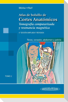 Atlas de bolsillo de cortes anatómicos : tomografía computarizada y resonancia magnética : tórax, corazón, abdomen y pelvis