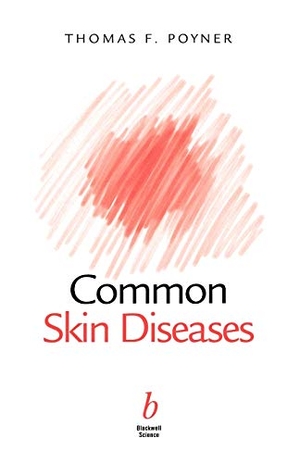 Poyner. Common Skin Diseases. John Wiley & Sons, 2000.