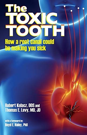 Kulacz, Dds Robert / Md Jd Levy. The Toxic Tooth - How a root canal could be making you sick. Medfox Publishing, 2014.