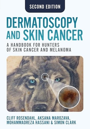 Marozava, Aksana / Rosendahl, Cliff et al. Dermatoscopy and Skin Cancer, second edition - A handbook for hunters of skin cancer and melanoma. Scion Publishing Ltd, 2025.