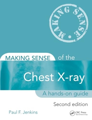 Jenkins, Paul. Making Sense of the Chest X-Ray - A Hands-On Guide. CRC Press, 2013.