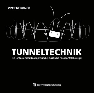 Ronco, Vincent. Tunneltechnik - Ein umfassendes Konzept für die plastische Parodontalchirurgie. Quintessenz Verlags-GmbH, 2024.