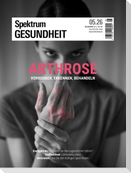 Spektrum Gesundheit 5/2026 - Arthrose