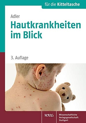 Adler, Yael. Hautkrankheiten im Blick - Ein Fotoatlas. Wissenschaftliche, 2015.