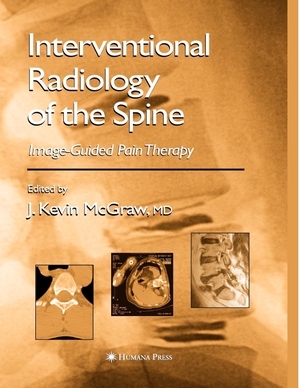 McGraw, J. Kevin (Hrsg.). Interventional Radiology of the Spine - Image-Guided Pain Therapy. Springer Nature B.V., 2010.