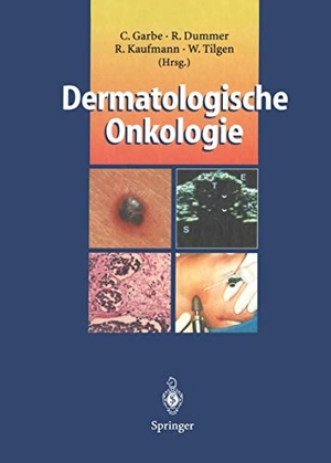 Garbe, Claus / Wolfgang Tilgen et al (Hrsg.). Dermatologische Onkologie. Springer Berlin Heidelberg, 2011.
