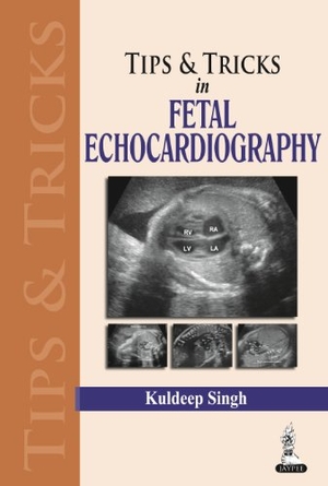 Singh, Kuldeep. Tips & Tricks in Fetal Echocardiography. Jaypee Brothers Medical Publishers Pvt Ltd, 2013.