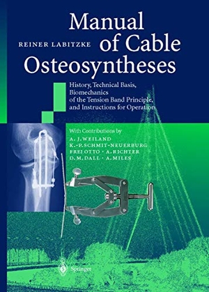 Labitzke, Reiner. Manual of Cable Osteosyntheses - History, Technical Basis, Biomechanics of the Tension Band Principle, and Instructions for Operation. Springer Berlin Heidelberg, 2012.