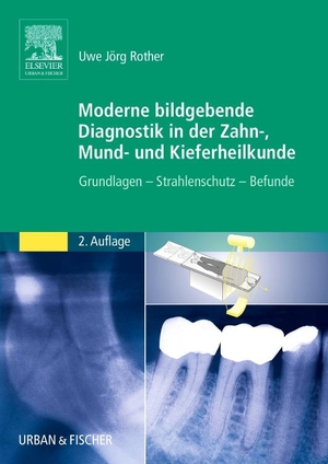 Rother, Uwe Jörg. Moderne bildgebende Diagnostik in der Zahn-, Mund- und Kieferheilkunde - Grundlagen - Strahlenschutz - Befunde. Urban & Fischer/Elsevier, 2006.