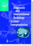 Diagnostic and Interventional Radiology in Liver Transplantation