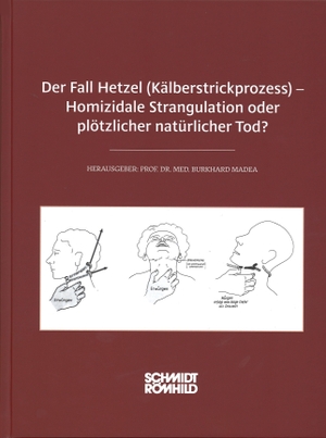 Madea, Burkhard (Hrsg.). Der Fall Hetzel (Kälberstrickprozess) - Homizidale Strangulation oder plötzlicher natürlicher Tod?. Schmidt - Roemhild, 2026.