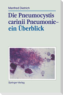 Die Pneumocystis carinii Pneumonie¿ ein Überblick