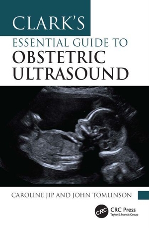 Jip, Caroline / John Tomlinson. Clark's Essential Guide to Obstetric Ultrasound. Taylor & Francis Ltd, 2026.