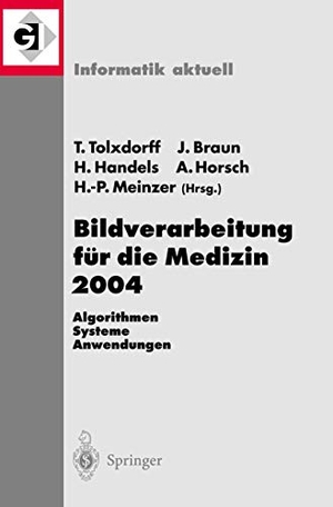 Tolxdorff, Thomas / Jürgen Braun et al (Hrsg.). Bildverarbeitung für die Medizin 2004 - Algorithmen - Systeme - Anwendungen. Springer Berlin Heidelberg, 2004.