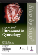Step by Step Ultrasound in Gynecology