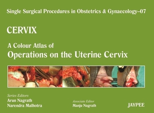 Nagrath, Arun / Malhotra, Narendra et al. Single Surgical Procedures in Obstetrics and Gynaecology - Volume 7 - CERVIX - A Colour Atlas of Operations on the Uterine Cervix. Jaypee Brothers Medical Publishers Pvt Ltd, 2013.