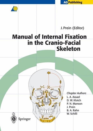 Prein, Joachim (Hrsg.). Manual of Internal Fixation in the Cranio-Facial Skeleton - Techniques Recommended by the AO/ASIF Maxillofacial Group. Springer Berlin Heidelberg, 2014.