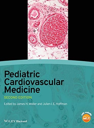 Moller. Pediatric Cardiovascular Medic. John Wiley & Sons, 2012.