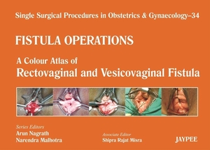 Nagrath, Arun / Malhotra, Narendra et al. Single Surgical Procedures in Obstetrics and Gynaecology - 34 - Fistula Operations - A Colour Atlas of Rectovaginal and Vesicovaginal Fistula. Jaypee Brothers Medical Publishers Pvt Ltd, 2013.