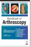 Handbook of Arthroscopy