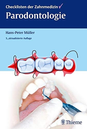 Müller, Hans-Peter. Checklisten der Zahnmedizin Parodontologie. Georg Thieme Verlag, 2012.
