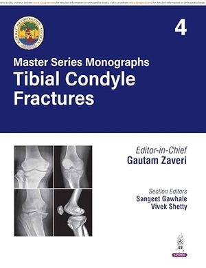 Zaveri, Gautam / Gawhale, Sangeet et al. Master Series Monographs - Tibial Condyle Fractures : Volume 4. Jaypee Brothers Medical Publishers Pvt Ltd, 2025.