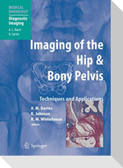 Imaging of the Hip & Bony Pelvis