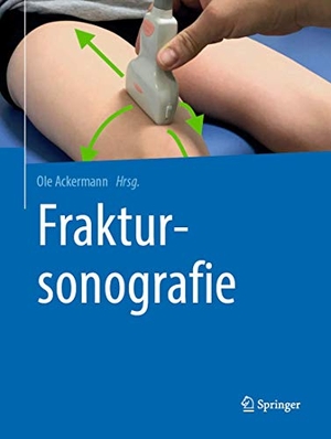 Ackermann, Ole (Hrsg.). Fraktursonografie. Springer, 2019.