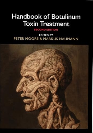 Moore / Naumann. Handbook of Botulinum Toxin Treatment 2e. John Wiley & Sons, 2003.