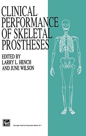 Hench / June Wilson. Clinical Perfomance of Skeletal Prostheses. Springer, 1995.