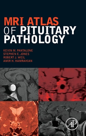 Pantalone, Kevin / Jones, Stephen et al. MRI Atlas of Pituitary Pathology. Elsevier Inc, 2015.