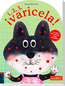 1, 2, 3, ¡varicela!