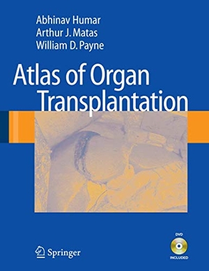 Humar, Abhinav / Payne, William D. et al. Atlas of Organ Transplantation. Springer London, 2008.