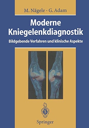 Nägele, Matthias / Gerhard Adam. Moderne Kniegelenkdiagnostik - Bildgebende Verfahren und klinische Aspekte. Springer Berlin Heidelberg, 2011.