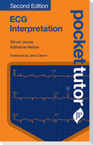 Pocket Tutor ECG Interpretation