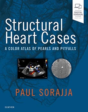 Sorajja, Paul / Pedersen, Wesley A et al. Structural Heart Cases - A Color Atlas of Pearls and Pitfalls. Elsevier Health Sciences, 2018.