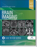 Brain Imaging: Case Review Series
