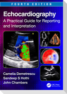 Echocardiography