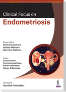 Clinical Focus on Endometriosis