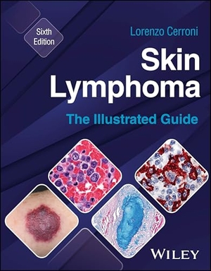 Cerroni, Lorenzo. Skin Lymphoma - The Illustrated Guide. Wiley John + Sons, 2026.