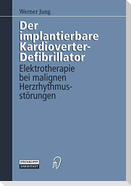 Der implantierbare Kardioverter-Defibrillator