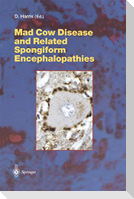 Mad Cow Disease and Related Spongiform Encephalopathies