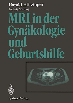 Hötzinger, Harald. MRI in der Gynäkologie und Geburtshilfe. Springer Berlin Heidelberg, 2011.