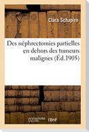 Des Néphrectomies Partielles En Dehors Des Tumeurs Malignes